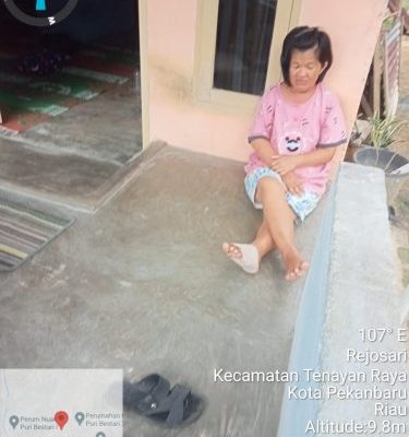 Program UHC Menolong Proses Operasi Ibu Togu, Terimakasih Pak Muflihun Kami Masyarakat Kecil Sangat Terbantu